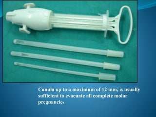 Canula up to a maximum of 12 mm, is usually
sufficient to evacuate all complete molar
pregnancies
 