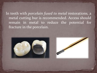 In teeth with porcelain fused to metal restorations, a
metal cutting bur is recommended. Access should
remain in metal to reduce the potential for
fracture in the porcelain.
14
 