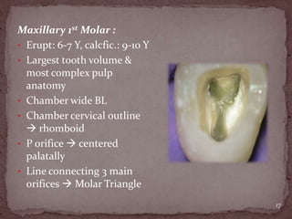 Maxillary 1st Molar :
• Erupt: 6-7 Y, calcfic.: 9-10 Y
• Largest tooth volume &
most complex pulp
anatomy
• Chamber wide BL
• Chamber cervical outline
 rhomboid
• P orifice  centered
palatally
• Line connecting 3 main
orifices  Molar Triangle
17
 