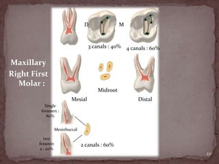 22
D M
3 canals : 40% 4 canals : 60%
Mesial
Midroot
Distal
Single
foramen :
80%
two
foramin
a : 20%
Mesiobuccal
2 canals : 60%
Maxillary
Right First
Molar :
 