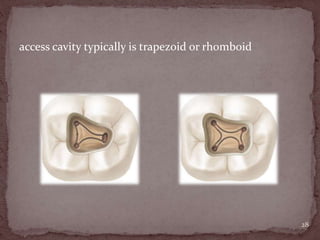 access cavity typically is trapezoid or rhomboid
28
 