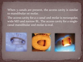 • When 3 canals are present, the access cavity is similar
to mandibular 1st molar.
• The access cavity for a 2 canal 2nd molar is rectangular,
wide MD and narrow BL. The access cavity for a single-
canal mandibular 2nd molar is oval.
32
 