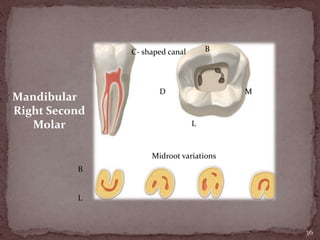 36
Mandibular
Right Second
Molar
MD
B
L
C- shaped canal
B
L
Midroot variations
 