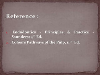 1. Endodontics - Principles & Practice -
Saunders; 4th Ed.
2. Cohen’s Pathways of the Pulp, 11th Ed.
41
 