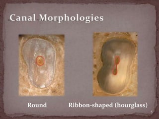 Round Ribbon-shaped (hourglass)
5
 