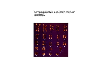 Гетерохроматин вызывает бэндинг хромосом 