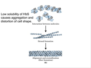 Low solubility of HbS
causes aggregation and
distortion of cell shape.
 
