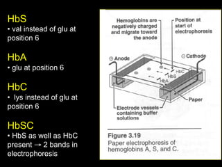 HbS
•  val instead of glu at
position 6

HbA
•  glu at position 6

HbC
•  lys instead of glu at
position 6

HbSC
•  HbS as well as HbC
present → 2 bands in
electrophoresis
 