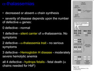 α-thalassemias
•  decreased or absent α chain synthesis
•  severity of disease depends upon the number
of defective α genes:
0 defective - normal
1 defective - silent carrier of α-thalassemia. No
symptoms
2 defective - α-thalassemia trait - no serious
symptoms
3 defective - Hemoglobin H disease - moderately
severe hemolytic anemia
all 4 defective - hydrops fetalis - fetal death (α
chains needed for HbF)
 