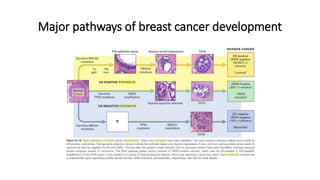 Major pathways of breast cancer development
 