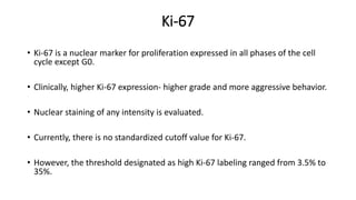 Ki-67
• Ki-67 is a nuclear marker for proliferation expressed in all phases of the cell
cycle except G0.
• Clinically, higher Ki-67 expression- higher grade and more aggressive behavior.
• Nuclear staining of any intensity is evaluated.
• Currently, there is no standardized cutoff value for Ki-67.
• However, the threshold designated as high Ki-67 labeling ranged from 3.5% to
35%.
 