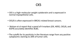 CK5
• CK5 is a high–molecular weight cytokeratin and is expressed in
normal myoepithelial cells.
• CK5/6 is often expressed in BRCA1-related breast cancers.
• Nielsen et al report that a panel of 4 markers (ER, HER2, CK5/6, and
EGFR) accurately identifies BLBC.
• The cutoffs for its positivity in the literature range from any positive
cytoplasmic staining to 20% of tumor cells.
 