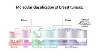 Molecular classification of breast tumors:
 