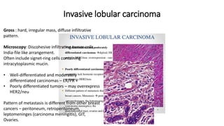 Invasive lobular carcinoma
Gross : hard, irregular mass, diffuse infiltrative
pattern.
Microscopy: Discohesive infiltrating tumor cells,
India-file like arrangement.
Often include signet-ring cells containing
intracytoplasmic mucin.
• Well-differentiated and moderately
differentiated carcinomas – ER/PR +
• Poorly differentiated tumors – may overexpress
HER2/neu
Pattern of metastasis is different from other breast
cancers – peritoneum, retroperitoneum,
leptomeninges (carcinoma meningitis), GIT,
Ovaries.
 