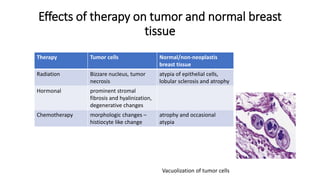 Effects of therapy on tumor and normal breast
tissue
Vacuolization of tumor cells
Therapy Tumor cells Normal/non-neoplastis
breast tissue
Radiation Bizzare nucleus, tumor
necrosis
atypia of epithelial cells,
lobular sclerosis and atrophy
Hormonal prominent stromal
fibrosis and hyalinization,
degenerative changes
Chemotherapy morphologic changes –
histiocyte like change
atrophy and occasional
atypia
 