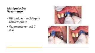 Manipulação/
Vazamento
• Utilizado em moldagem
com casquete
• Vazamento em até 7
dias
 
