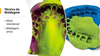 Técnica de
Moldagem
• Alívio
interdental
• Moldagem
única
 