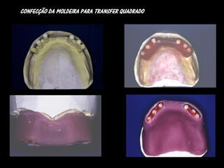 CONFECÇÃO DA MOLDEIRA PARA TRANSFER QUADRADO
 
