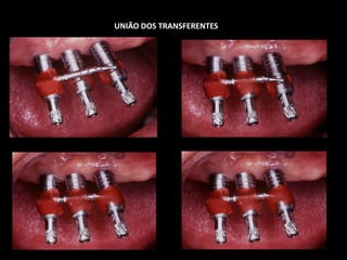 UNIÃO DOS TRANSFERENTES
 
