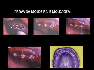 PROVA DA MOLDEIRA E MOLDAGEM
 