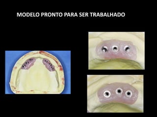 MODELO PRONTO PARA SER TRABALHADO
 