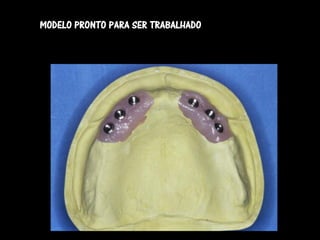 MODELO PRONTO PARA SER TRABALHADO
 