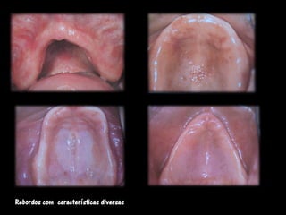 Rebordos com características diversas
 