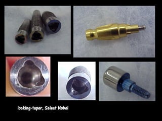 locking-taper, Select Nobel
 