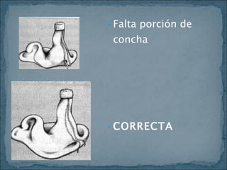 Falta porción de concha CORRECTA 