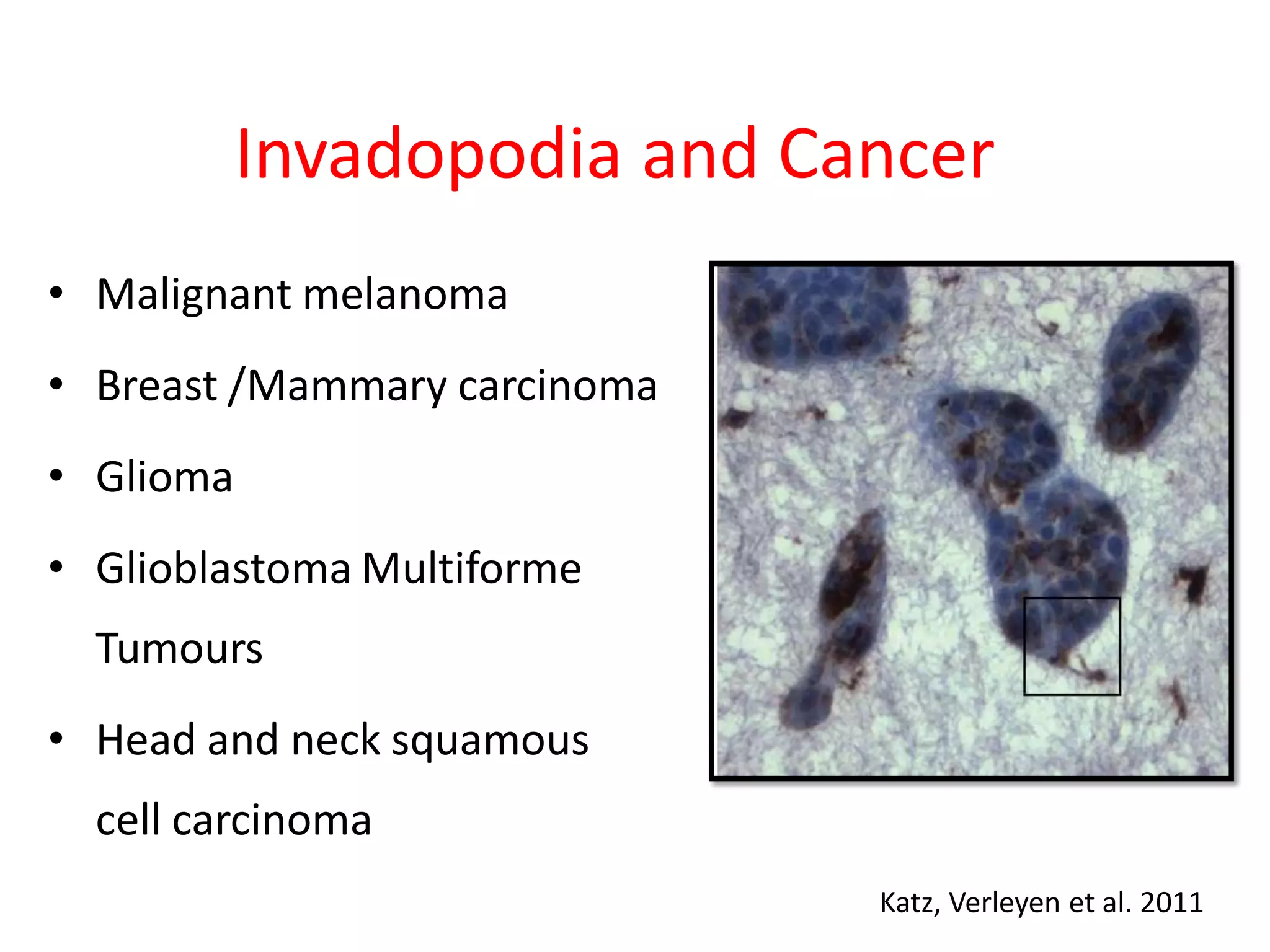 Invadopodia and Cancer
• Malignant melanoma
• Breast /Mammary carcinoma
• Glioma
• Glioblastoma Multiforme
Tumours
• Head and neck squamous
cell carcinoma
Katz, Verleyen et al. 2011
 