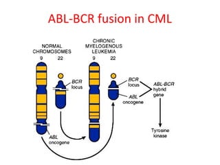ABL-BCR fusion in CML
 