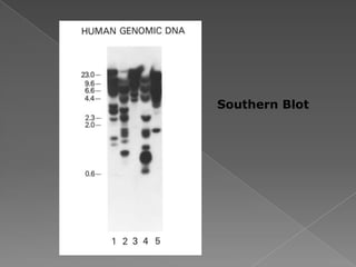 Southern Blot
 