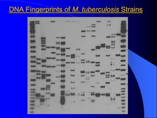 DNA Fingerprints of M. tuberculosis Strains
 