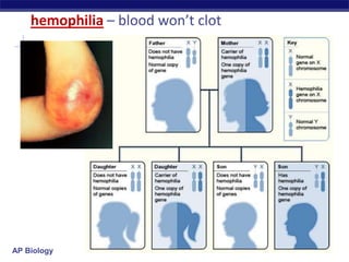 AP Biology
hemophilia – blood won’t clot
 