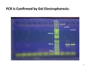 PCR	
  is	
  Conﬁrmed	
  by	
  Gel	
  Electrophoresis:	
  
1000	
  bp	
  
500	
  bp	
  
100	
  bp	
  
Ladder	
  
-­‐	
  control	
  
sample	
  
+	
  control	
  
26	
  
 