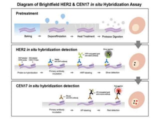 Molecular profiling of breast cancer | PPTX