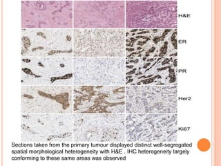 Molecular profiling of breast cancer | PPTX