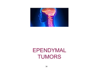 EPENDYMAL
TUMORS
34
 