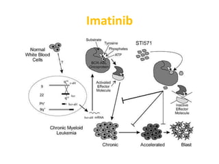 Imatinib
 