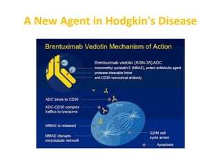 A New Agent in Hodgkin's Disease
 