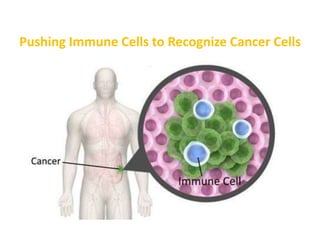 Pushing Immune Cells to Recognize Cancer Cells
 