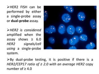 HER2 FISH can be
performed by either
a single-probe assay
or dual-probe assay.
HER2 is considered
amplified when the
assay shows ≥ 6.0
HER2 signals/cell
using a single-probe
system.
By dual-probe testing, it is positive if there is a
HER2/CEP17 ratio of ≥ 2.0 with an average HER2 copy
number of ≥ 4.0
 
