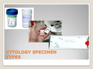 CYTOLOGY SPECIMEN
TYPES
 