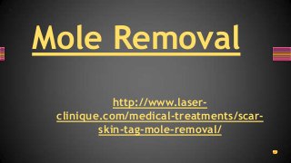 Mole Removal
http://www.laser-
clinique.com/medical-treatments/scar-
skin-tag-mole-removal/
 
