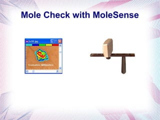 Mole Check with MoleSense
www.MoleSense.com
 