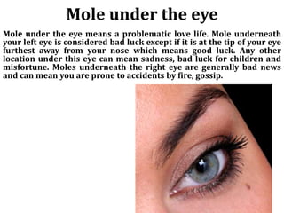 Mole under the eye
Mole under the eye means a problematic love life. Mole underneath
your left eye is considered bad luck except if it is at the tip of your eye
furthest away from your nose which means good luck. Any other
location under this eye can mean sadness, bad luck for children and
misfortune. Moles underneath the right eye are generally bad news
and can mean you are prone to accidents by fire, gossip.
 