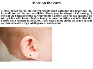 Mole on the ears
A mole anywhere on the ear represents good earnings and luxurious life.
Expenditure will be uncontrollable. There may be danger of drowning. A
mole at the backside of the ear represents a person who follows customs. He
will get his wife from a higher family. A mole on either ear tells that the
person has a reckless disposition. If you have a mole on the tip or top of your
ear this indicates a high intelligence or astute mind
 
