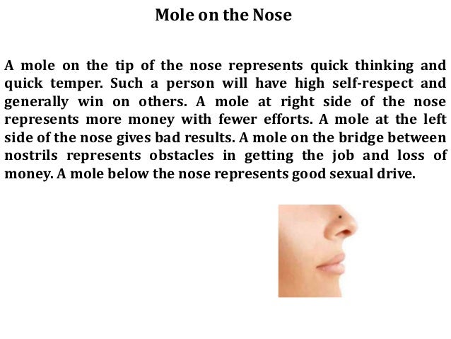 Moles On Body moles on body