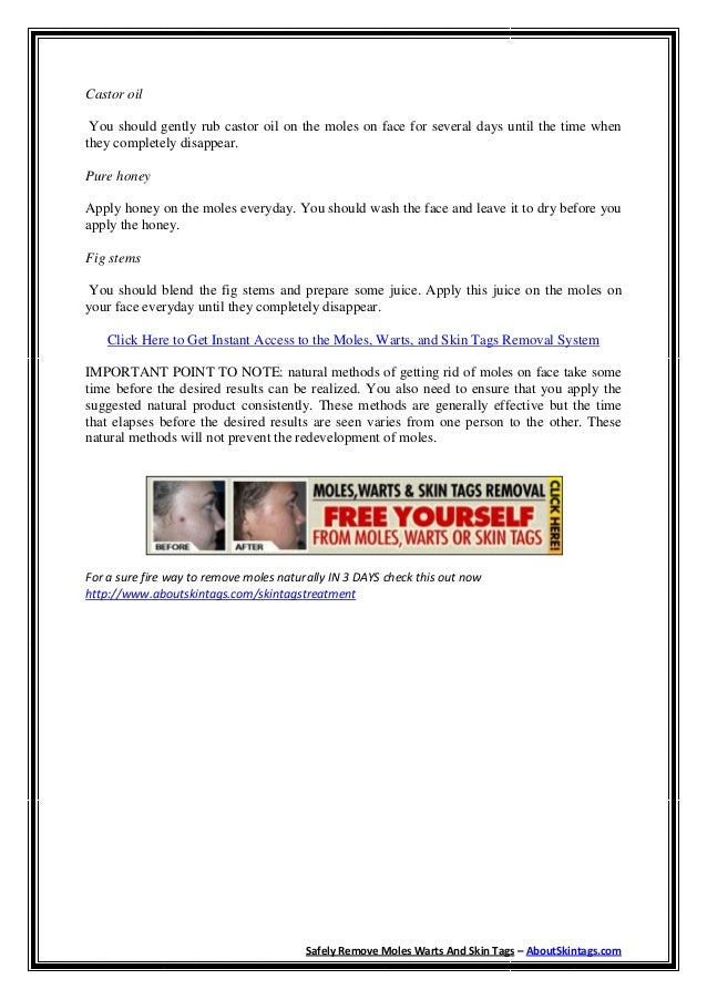 Natural Ways To Get Rid Of Moles On Face Natural Ways To Get Rid Of Moles On Face