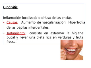 Gingivitis:
Inflamación localizada o difusa de las encías.
- Causas: Aumento de vascularización Hipertrofia
de las papilas interdentales.
- Tratamiento: consiste en extremar la higiene
bucal y llevar una dieta rica en verduras y fruta
fresca.
 